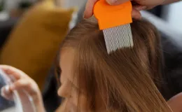 Après-traitement 